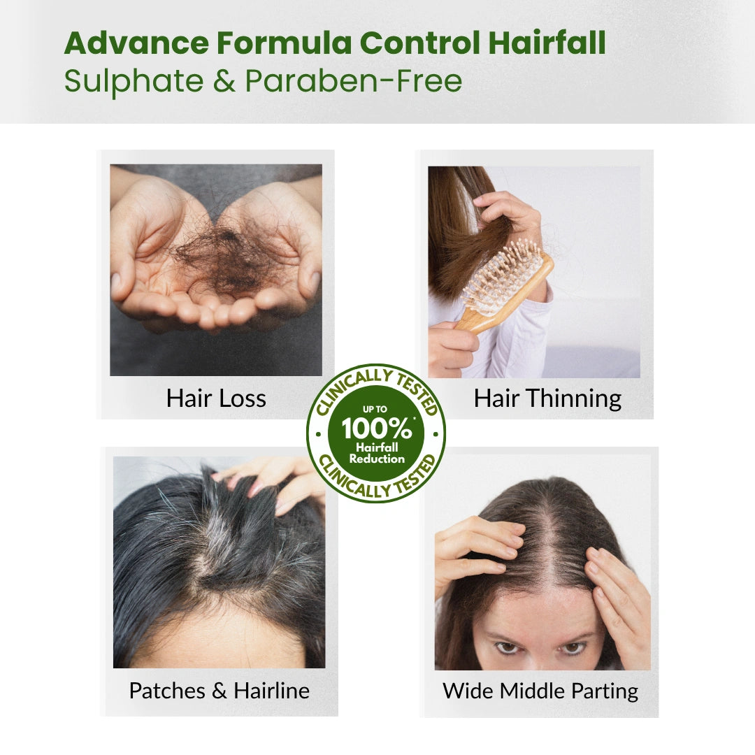 Root Resilience (Anti Hair fall) Non-Drying Shampoo Sulfate Free, Paraben free