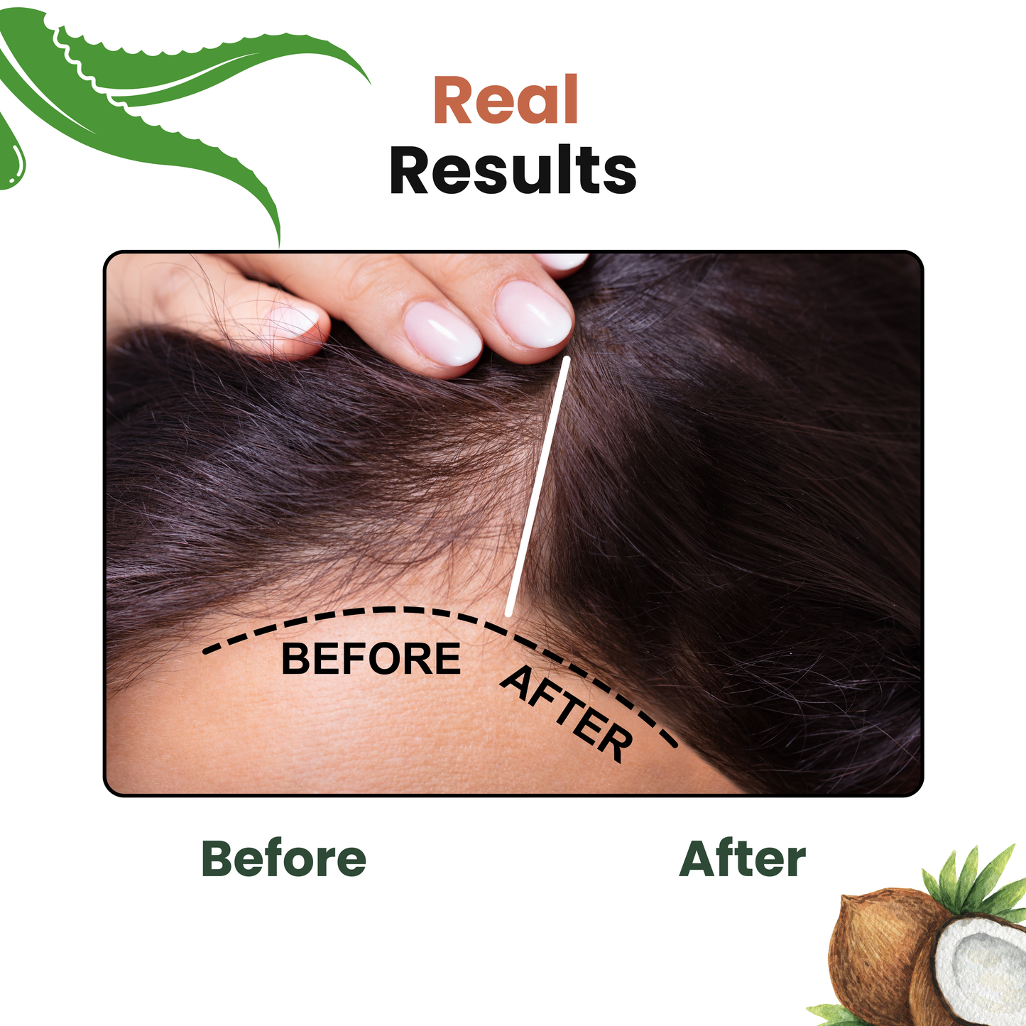 Root Resilience (Anti Hair fall) Non-Drying Shampoo Sulfate Free, Paraben free