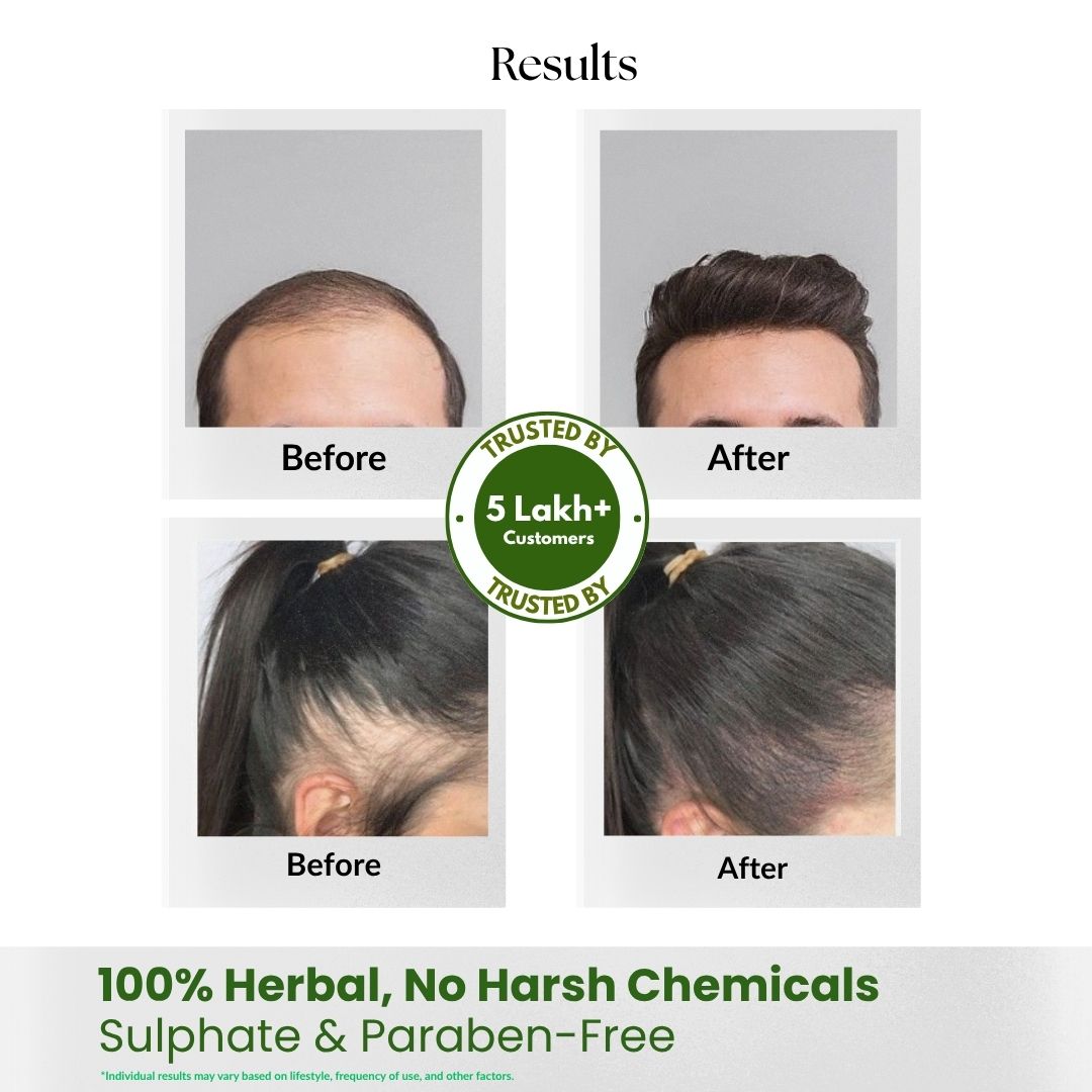 Non-Drying Clarifying Shampoo Sulfate Free Infinite♾️Care (Multi Benefit), Paraben free