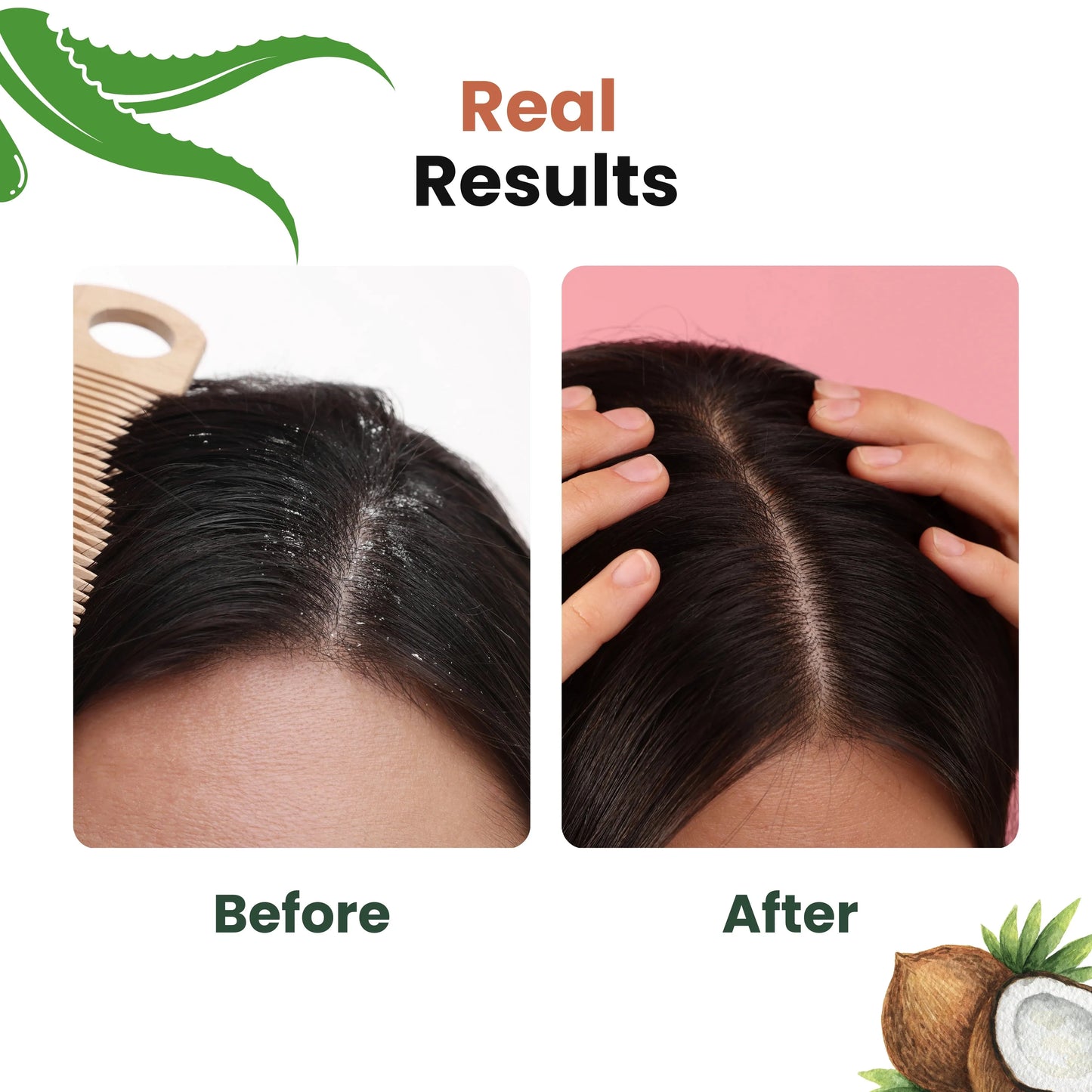 Dandruff Detox (Anti Dandruff) Non-Drying Shampoo Sulfate Free, Paraben free