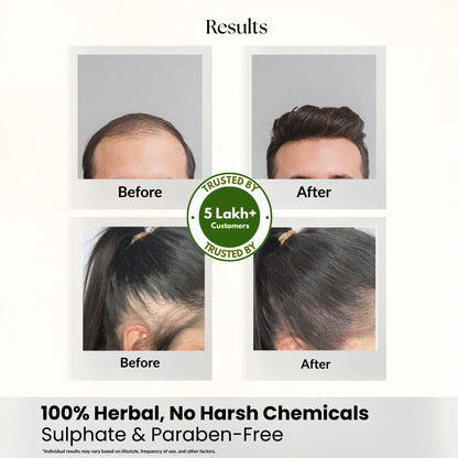 Root Resilience (Anti Hair fall) Non-Drying Shampoo Sulfate Free, Paraben free