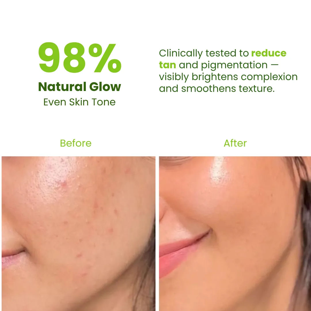 Tan-Detox Charcoal Infusion Pack Herbal | 50g