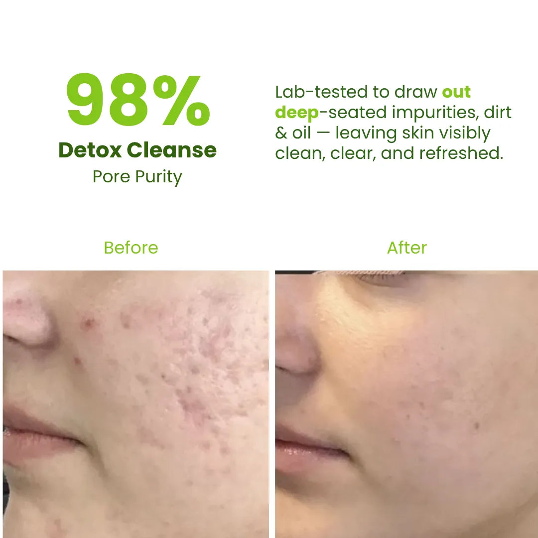 Glow and Radiance Multani Face Pack | 50g