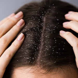 Dandruff