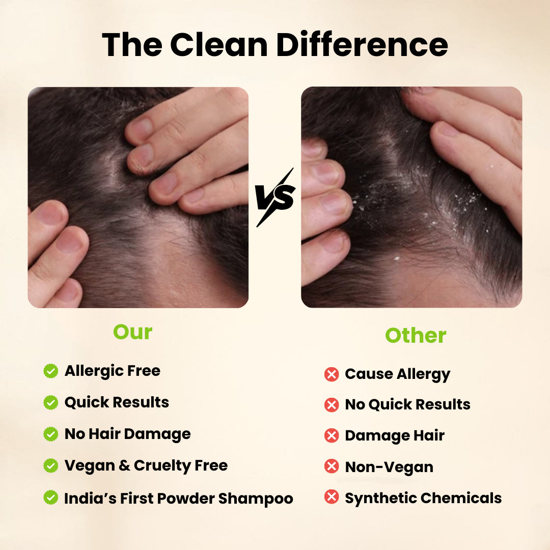 Dandruff Detox (Anti Dandruff) Non-Drying Shampoo Sulfate Free, Paraben free