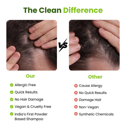 Dandruff Detox (Anti Dandruff) Non-Drying Shampoo Sulfate Free, Paraben free