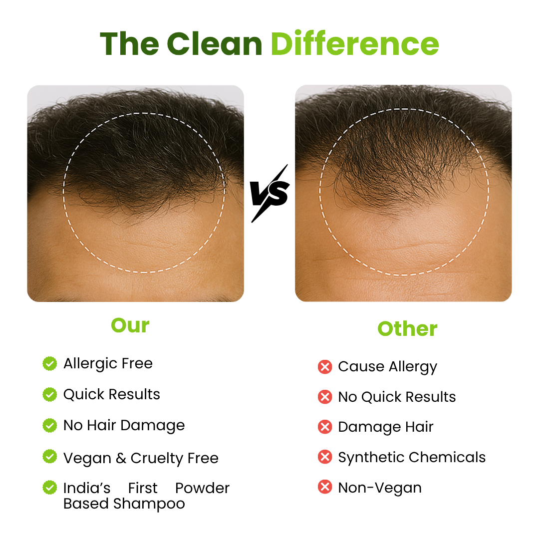 Root Resilience (Anti Hair fall) Non-Drying Shampoo Sulfate Free, Paraben free